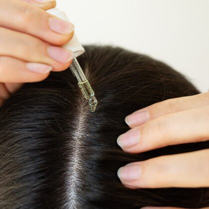 hair-loss-treatment