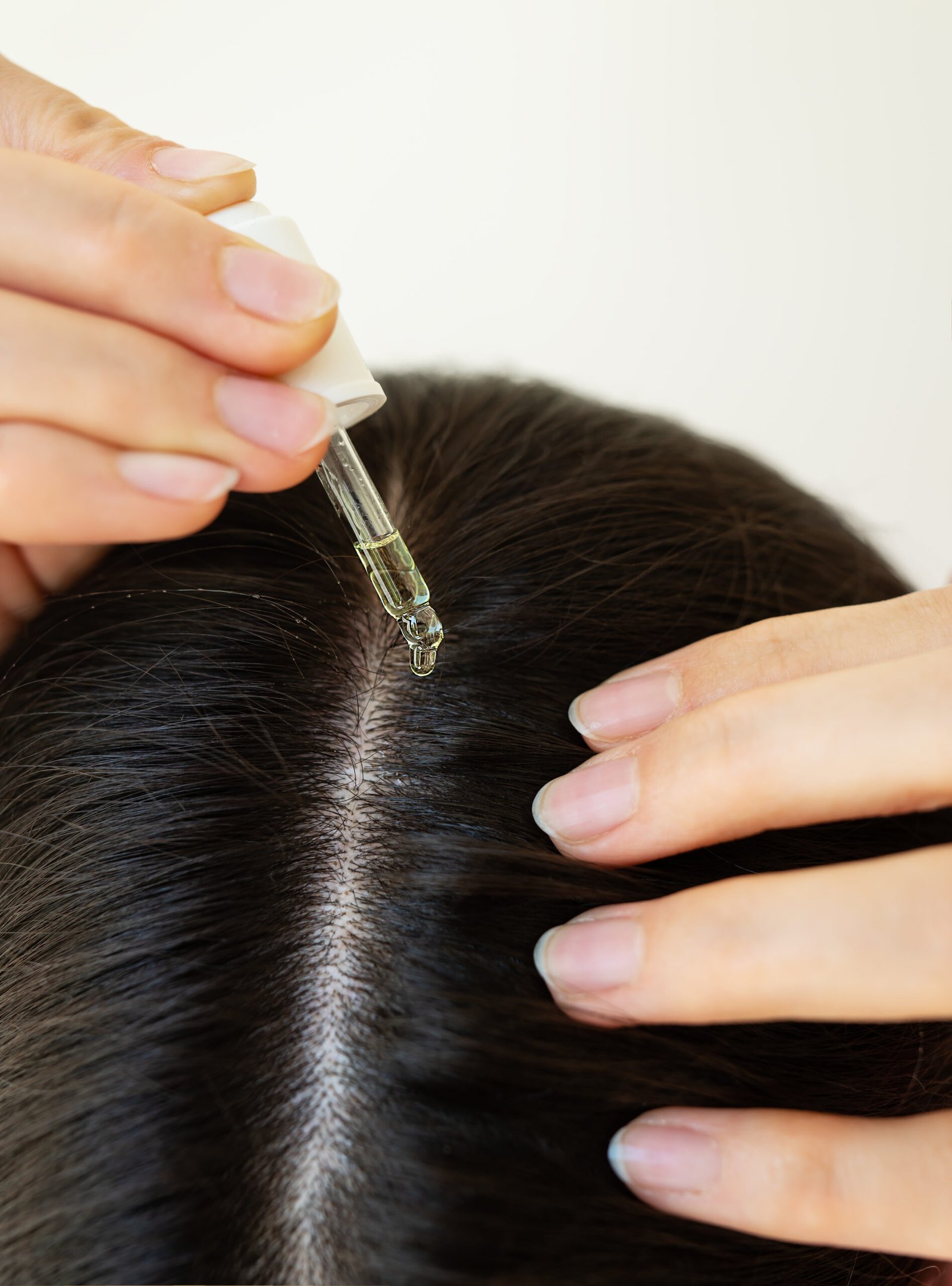 hair-loss-treatment