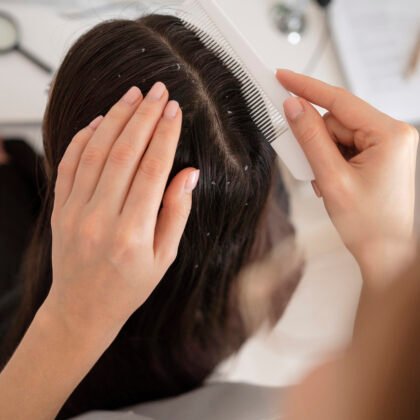 dandruff treatment